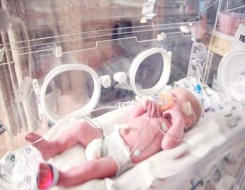 الدار البيضاء اليوم  - الولادة المبكرة مرتبطة بارتفاع مخاطر الإصابة باضطراب فرط الحركة ونقص الانتباه
