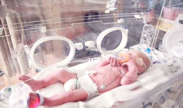 ارتفاع عدد الولادات القيصرية بشكل غير مسبوق في مصر