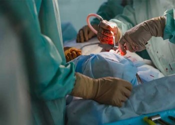 الدار البيضاء اليوم  - رفض زراعة قلب لمريض لم يتلقّ لقاح كورونا في مستشفى أميركي