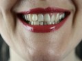 الدار البيضاء اليوم  - سوء صحة الأسنان يُعرضك لخطر تلف الرئة