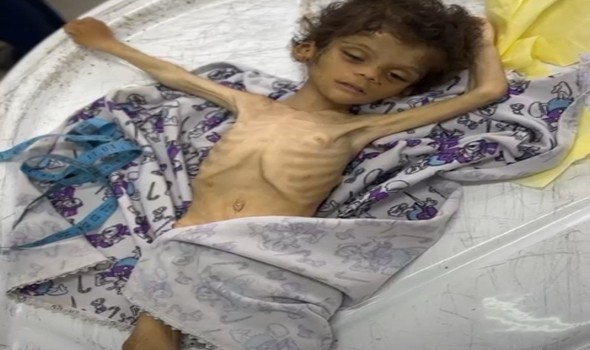 الذكاء الإصطناعي يخطأ بإتهام نائب فرنسي إستخدام صورة غير صحيحة للمجاعة في غزّة